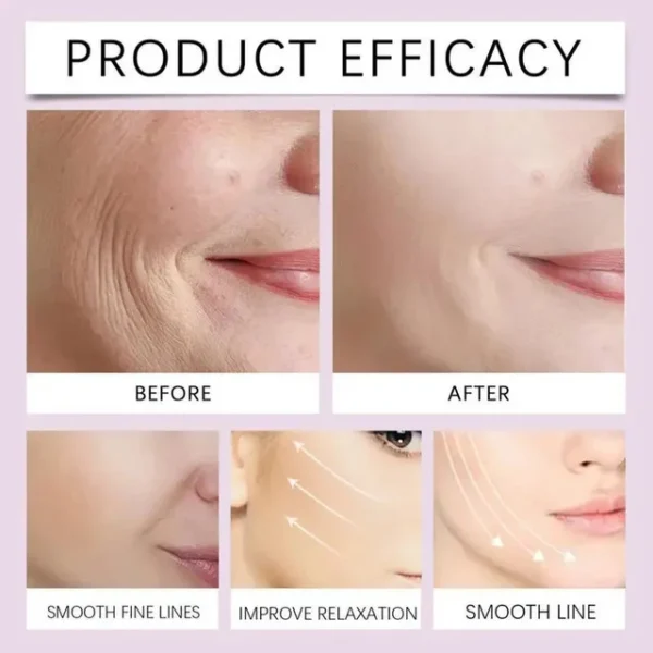 Neck Lifting Tape Invisible Face lift Tape - Image 5