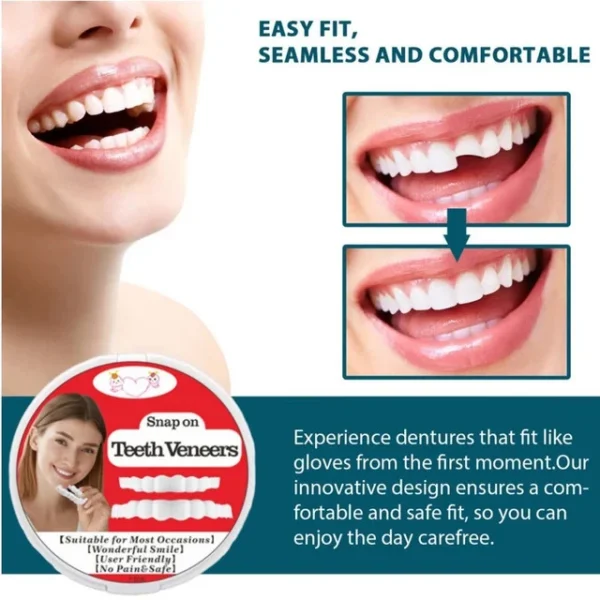 Snap-On Fake Tooth Veneers for Confidence - Image 2