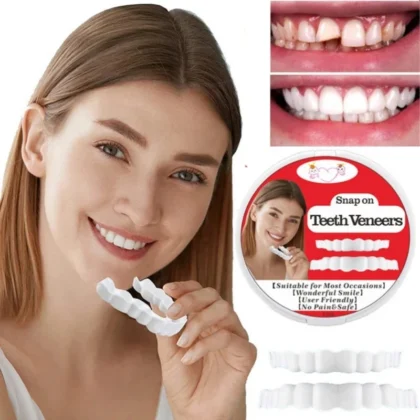 Snap-On Fake Tooth Veneers for Confidence