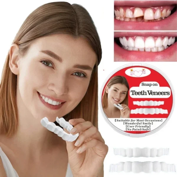 Snap-On Fake Tooth Veneers for Confidence